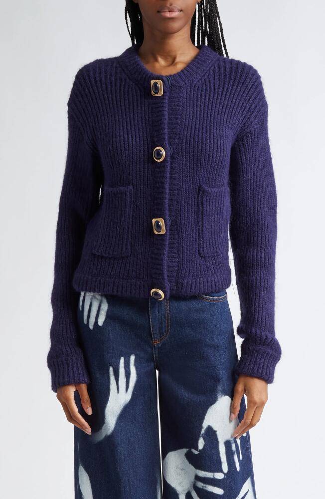 Area Statement Button Cardigan in Midnight Blue Cover